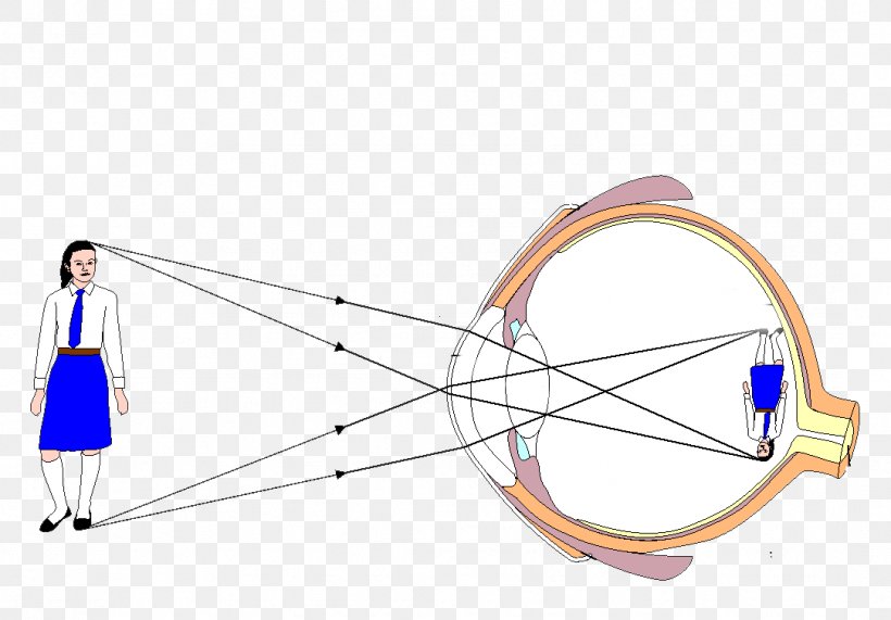 Eye Pattern Diagram Light Human Eye, PNG, 1083x755px, Eye, Arm, Biology, Diagram, Eye Pattern Download Free