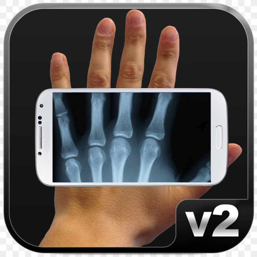 Xray Scanner Prank X-ray Scanner Prank Android X Ray Cloth Scan Camera Prank, PNG, 1024x1024px, Xray Scanner Prank, Android, Electronic Device, Electronics, Finger Download Free