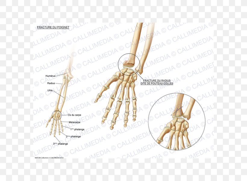 Bone Fracture Carpal Bones Wrist Pisiform Bone, PNG, 600x600px, Watercolor, Cartoon, Flower, Frame, Heart Download Free