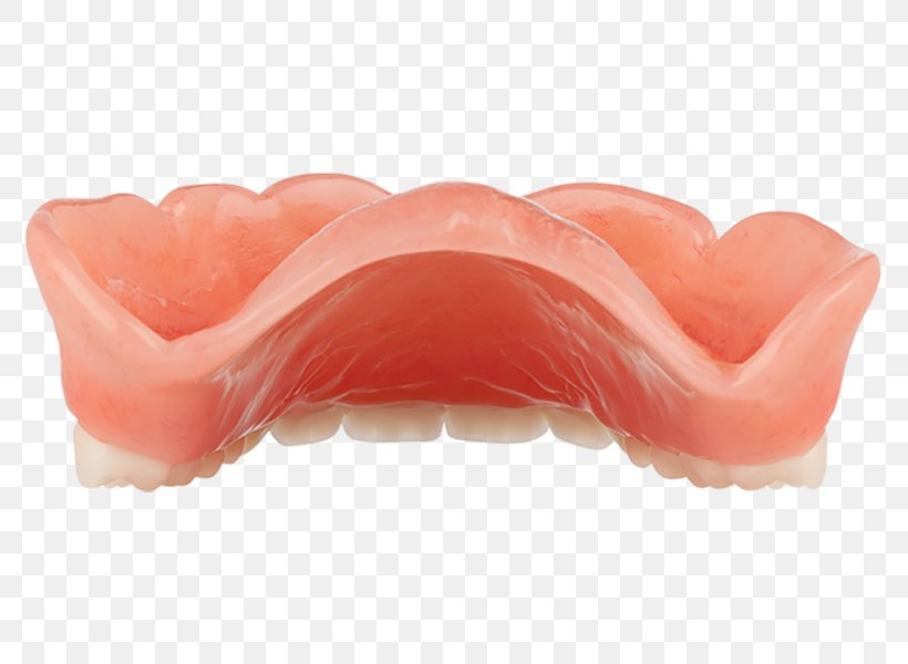 Mouth Dentures, PNG, 800x600px, Mouth, Dentures, Jaw, Lip, Peach Download Free