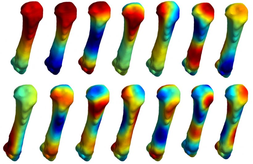 Human Musculoskeletal System Carpal Bones Musculoskeletal Disorder Research, PNG, 1020x662px, Human Musculoskeletal System, Bone, Carpal Bones, Disease, Finger Download Free