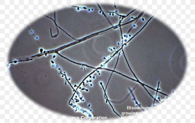 Blastomyces Dermatitidis Fungus Blastomycosis White Piedra Microscopy, PNG, 785x517px, Fungus, Candida Albicans, Candidiasis, Conidium, Histoplasma Capsulatum Download Free