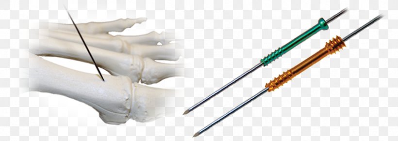 Screw Translation Tool Implant Bone, PNG, 847x300px, Screw, Bone, Compressive Strength, Dental Implant, English Language Download Free