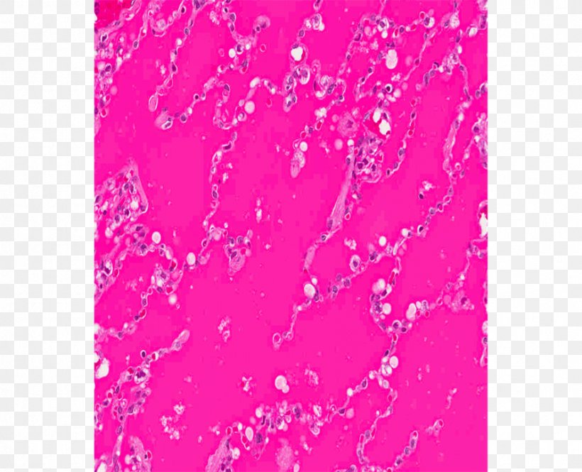 Pink M RTV Pink Wallpaper, PNG, 891x723px, Pink M, Glitter, Heart, Magenta, Petal Download Free