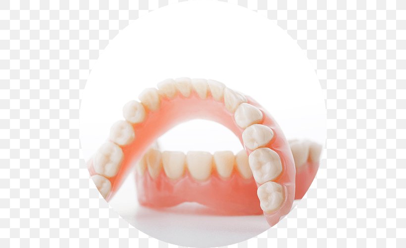 Dentistry Dentures Southwood Dental Studio Tooth, PNG, 500x500px, Dentist, Bridge, Clinic, Cosmetic Dentistry, Dental Implant Download Free
