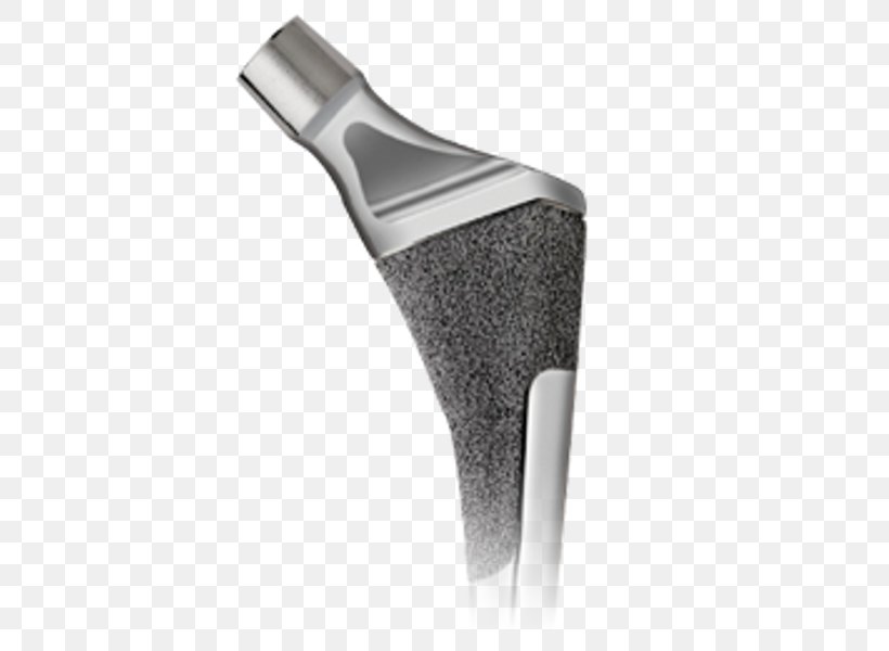 Trabecula Femur Zimmer Biomet Hip Implant, PNG, 600x600px, Trabecula, Acetabulum, Bone, Bone Fracture, Femur Download Free