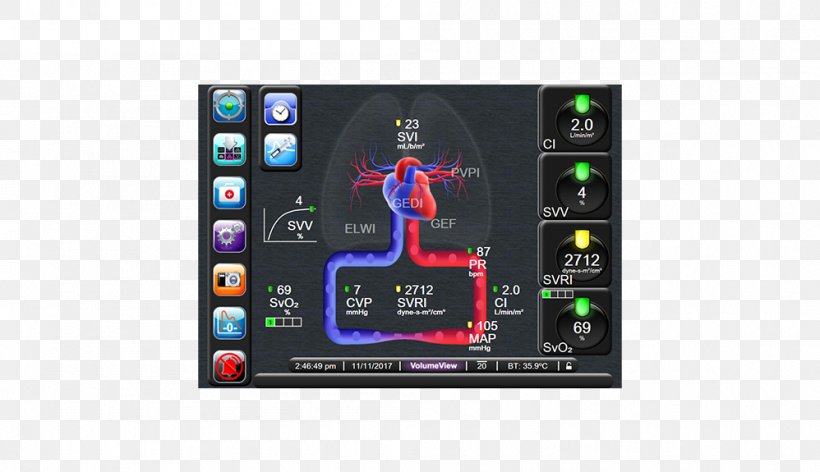 Display Device Cardiac Output Stroke Volume, PNG, 998x575px, Display Device, Blog, Cardiac Output, Computer Hardware, Edwards Lifesciences Download Free