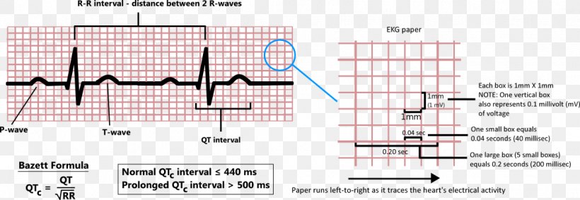 QT Interval Diagram Point Health Care Angle, PNG, 1117x386px, Qt Interval, Diagram, Formula, Health Care, Parallel Download Free