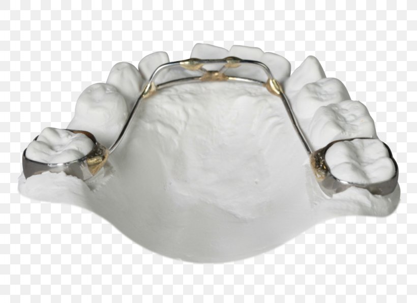 Gergen's Orthodontic Lab Orthodontics Tongue Sagittal Plane Retainer, PNG, 1024x745px, Orthodontics, Bionator, Body Jewellery, Body Jewelry, Clear Aligners Download Free