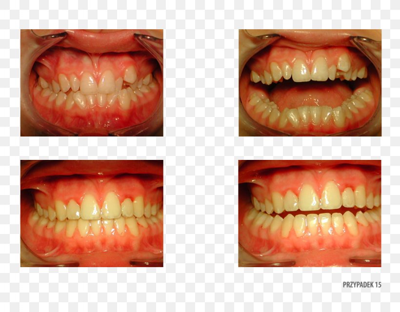 Orange Polska Close-up Therapy Patient, PNG, 1024x800px, Orange, Close Up, Closeup, Jaw, Jawpl Jaworzno Social Network Download Free
