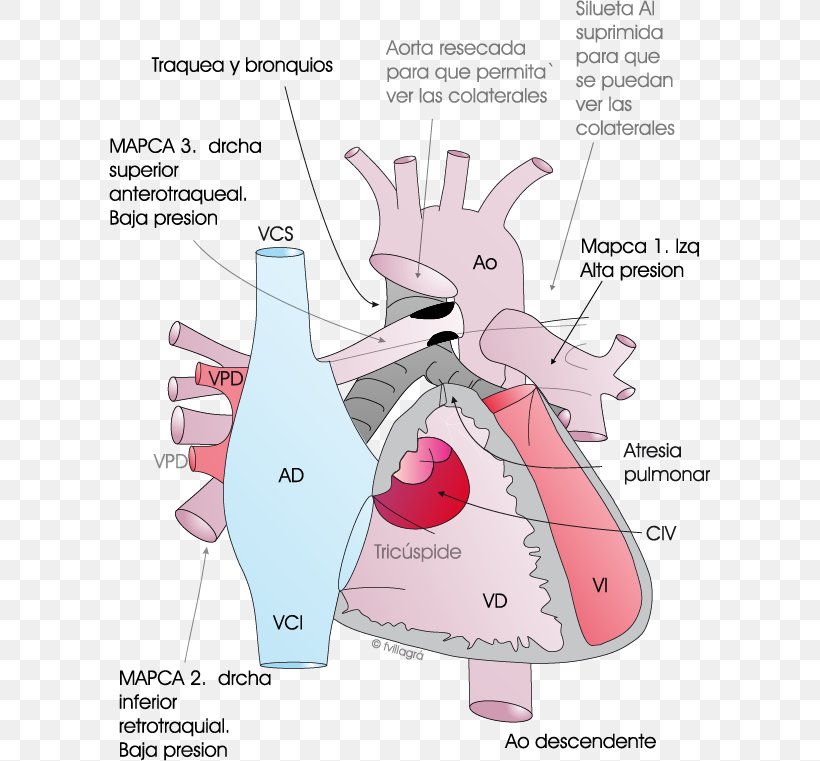 Pulmonary Atresia Ventricular Septal Defect Pulmonary Artery Aorta, PNG, 601x761px, Watercolor, Cartoon, Flower, Frame, Heart Download Free