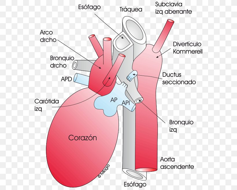 Aberrant Subclavian Artery Aortic Arch Aorta Diverticolo Di Kommerell, PNG, 595x656px, Watercolor, Cartoon, Flower, Frame, Heart Download Free