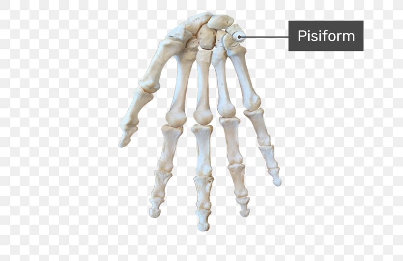 Carpal Bones Triquetral Bone Anatomy Wrist Carpal Tunnel, PNG, 770x533px, Carpal Bones, Anatomy, Arm, Bone, Bone Fracture Download Free