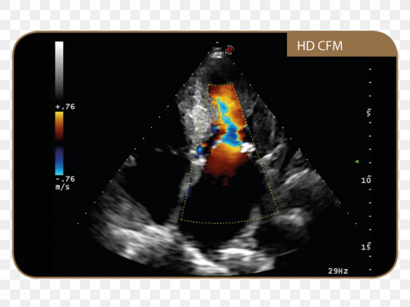 Ultrasonography Esaote Medical Equipment Magnetic Resonance Imaging Medical Diagnosis, PNG, 1200x900px, Ultrasonography, Electronics, Esaote, Gadget, Human Factors And Ergonomics Download Free