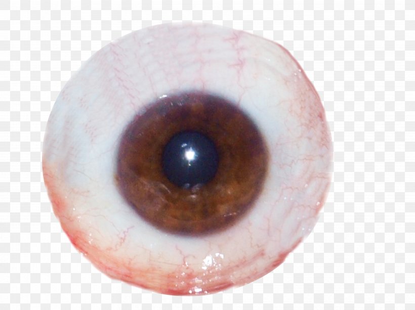 Iris Ocular Prosthesis Human Eye Optician, PNG, 3654x2736px, Watercolor, Cartoon, Flower, Frame, Heart Download Free