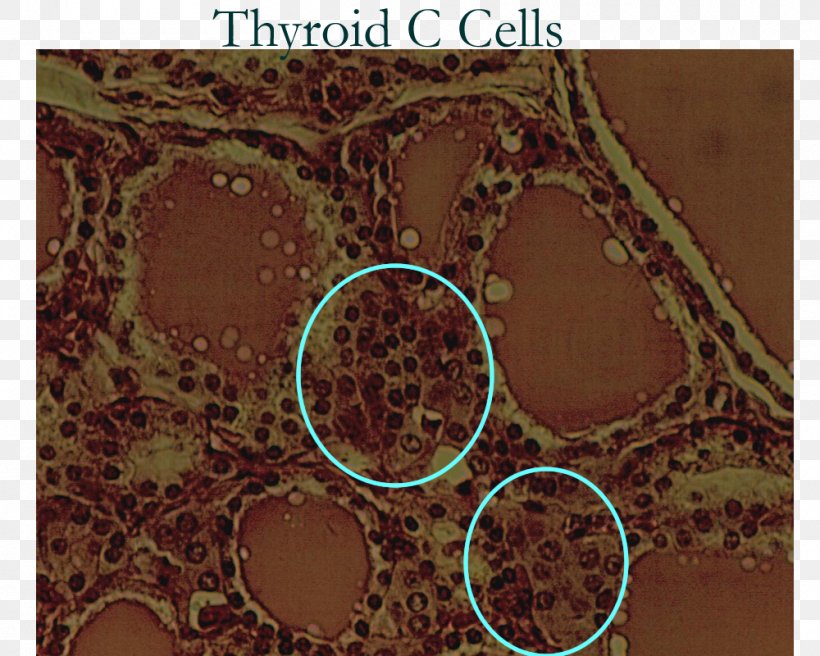 Parafollicular Cell Thyroid Endocrine System, PNG, 1000x800px, Follicular Cell, Biology, Brown, Cell, Endocrine Gland Download Free