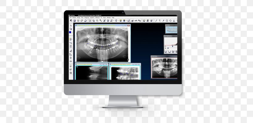 Computer Software Medical Imaging Radiology Imagerie KaVo Dental GmbH, PNG, 702x400px, Computer Software, Brand, Computer Monitor, Computer Monitor Accessory, Dentistry Download Free