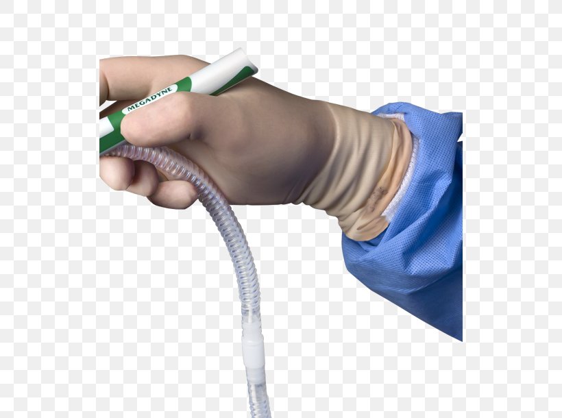 Johnson & Johnson Electrosurgery Ethicon Endo-Surgery Medical Device Health Care, PNG, 530x610px, Johnson Johnson, Arm, Electrosurgery, Finger, Hand Download Free