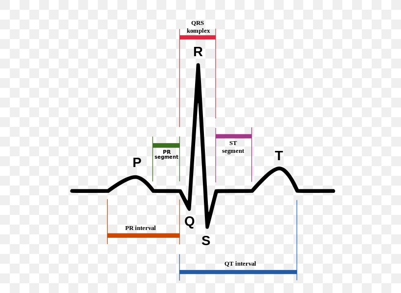 Sinus Rhythm Electrocardiography Heart Sinus Tachycardia Atrium, PNG, 800x600px, Sinus Rhythm, Area, Atrial Fibrillation, Atrium, Brand Download Free