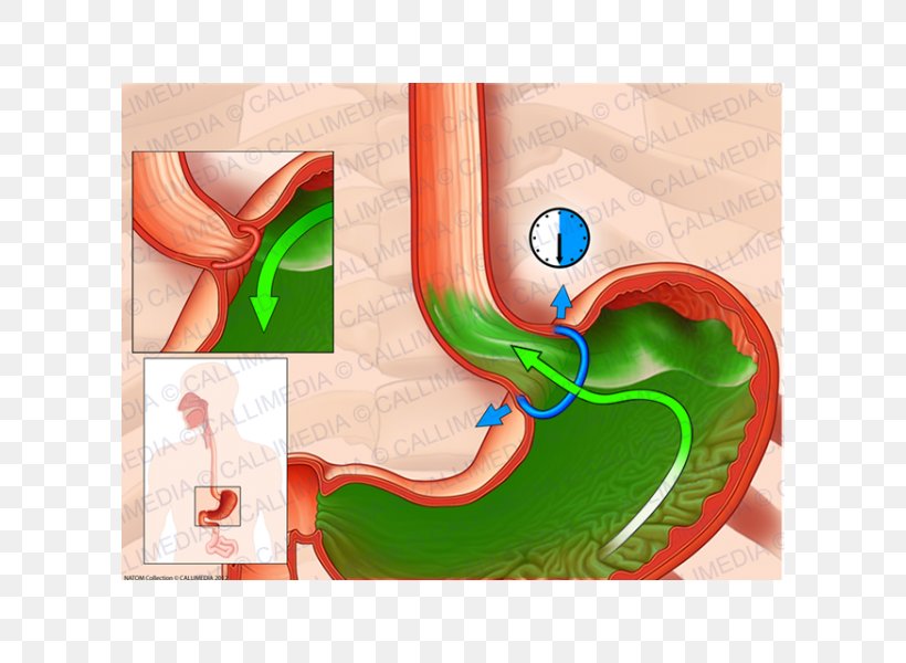 Esophagus Upper Esophageal Sphincter Cardia Sfintere Esofageo Inferiore, PNG, 600x600px, Watercolor, Cartoon, Flower, Frame, Heart Download Free