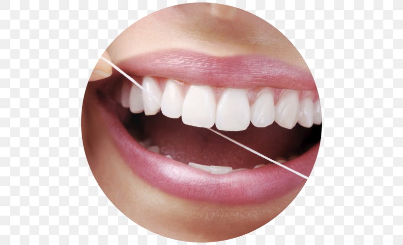 Dental Floss Periodontal Disease Dentistry Human Tooth, PNG, 500x500px, Dental Floss, Chin, Close Up, Cosmetic Dentistry, Dental Plaque Download Free