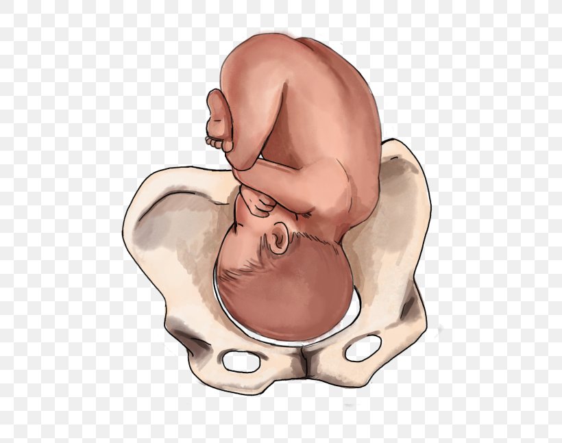 Childbirth Fetal Position Infant Breech Birth, PNG, 500x647px, Watercolor, Cartoon, Flower, Frame, Heart Download Free
