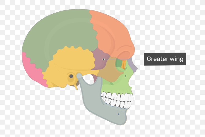 Skull Greater Wing Of Sphenoid Bone Sphenoid Wing Meningioma, PNG, 698x550px, Skull, Base Of Skull, Bone, Frontal Bone, Greater Wing Of Sphenoid Bone Download Free