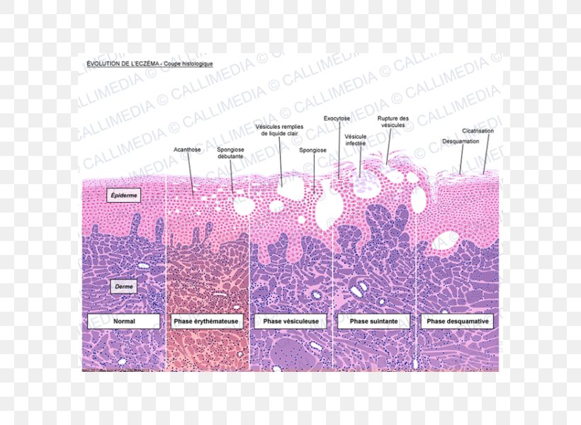Introduction To Histology Dermatitis Keratinocyte Corte Histológico, PNG, 600x600px, Histology, Biology, Brand, Cell, Contact Dermatitis Download Free