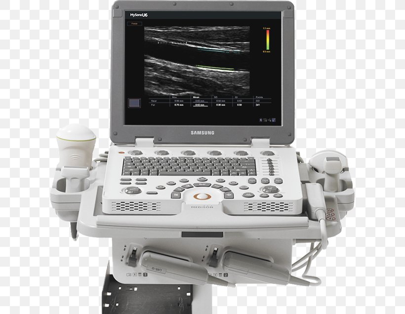 Medical Equipment Ultrasound Medicine Ultrasonography Ecógrafo, PNG, 617x636px, 3d Ultrasound, Medical Equipment, Computer Monitor Accessory, Electronics, Machine Download Free