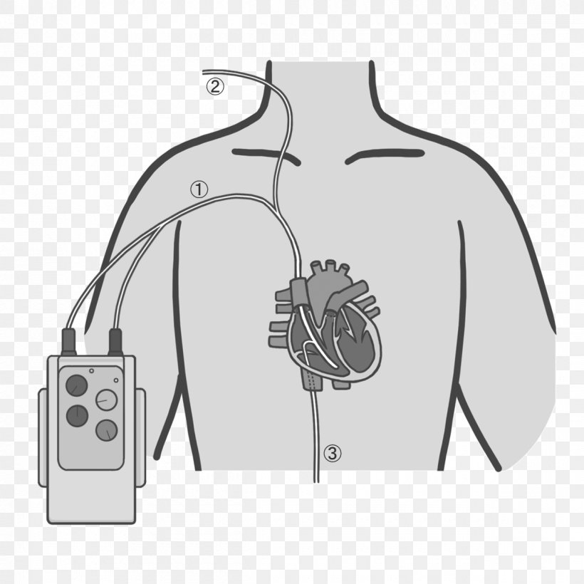 Artificial Cardiac Pacemaker Nursing Medical Device Illustration Automated External Defibrillators, PNG, 1200x1200px, Watercolor, Cartoon, Flower, Frame, Heart Download Free