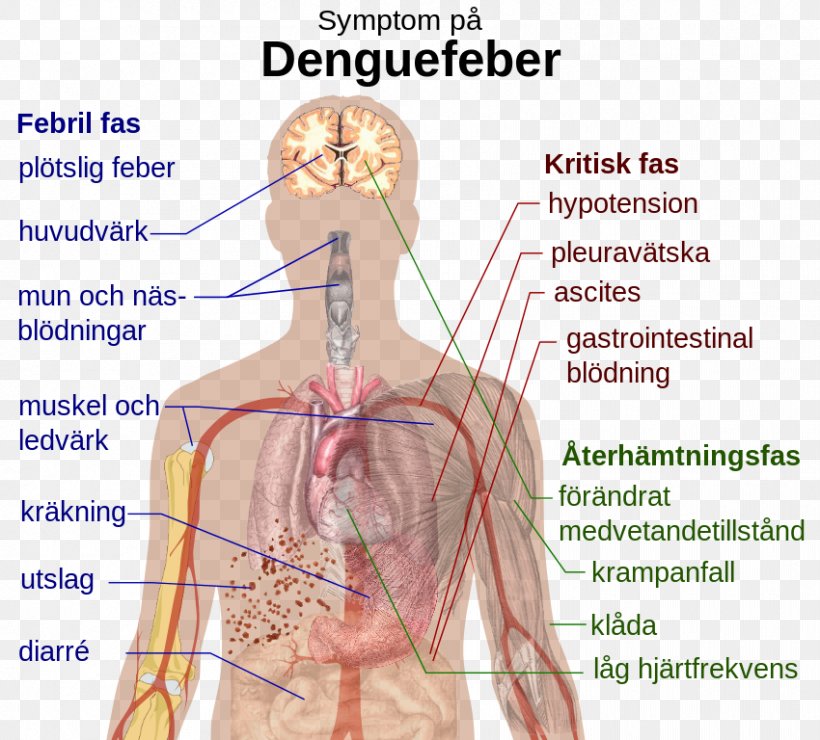 Dengue Virus Symptom Viral Hemorrhagic Fever, PNG, 850x768px, Watercolor, Cartoon, Flower, Frame, Heart Download Free