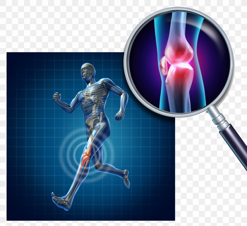Knee Pain Joint Bone Anatomy, PNG, 6170x5646px, Joint, Anatomy, Bone, Cartilage, Femur Download Free