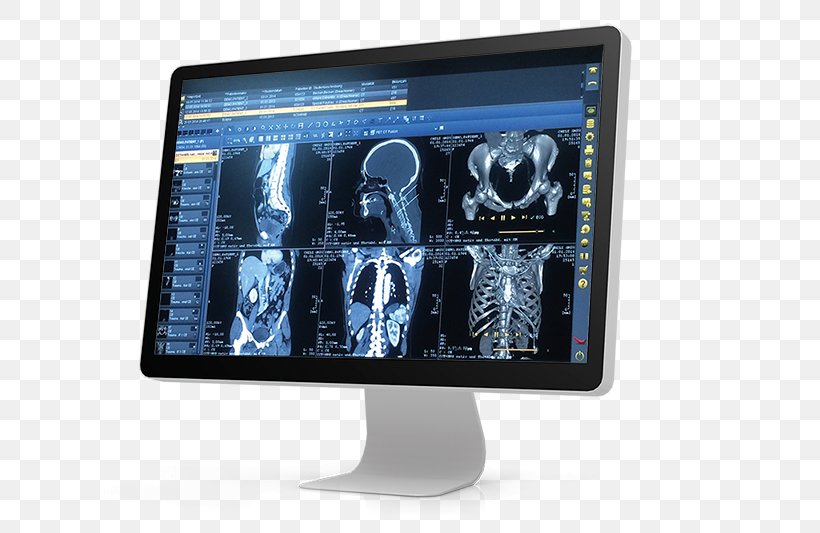 Picture Archiving And Communication System DICOM Medical Imaging Physician Hospital, PNG, 800x533px, Dicom, Brand, Computer Monitor, Computer Monitor Accessory, Computer Software Download Free