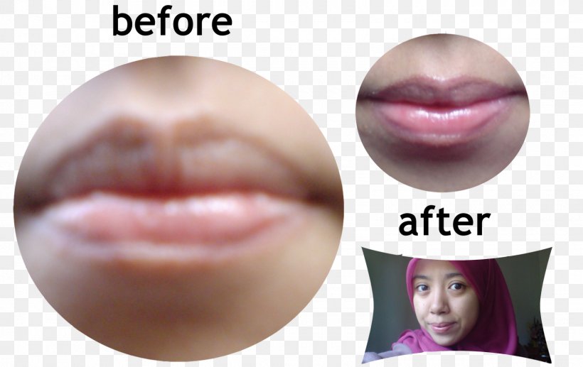 Lip Gloss Lipstick Close-up Eyelash, PNG, 1600x1010px, Lip Gloss, Beauty, Beautym, Cheek, Chin Download Free
