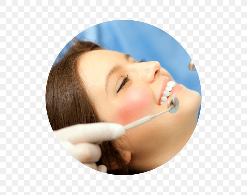 Dentistry Wisdom Tooth Tooth Decay, PNG, 650x650px, Dentistry, Cheek, Chin, Cosmetic Dentistry, Dental Extraction Download Free