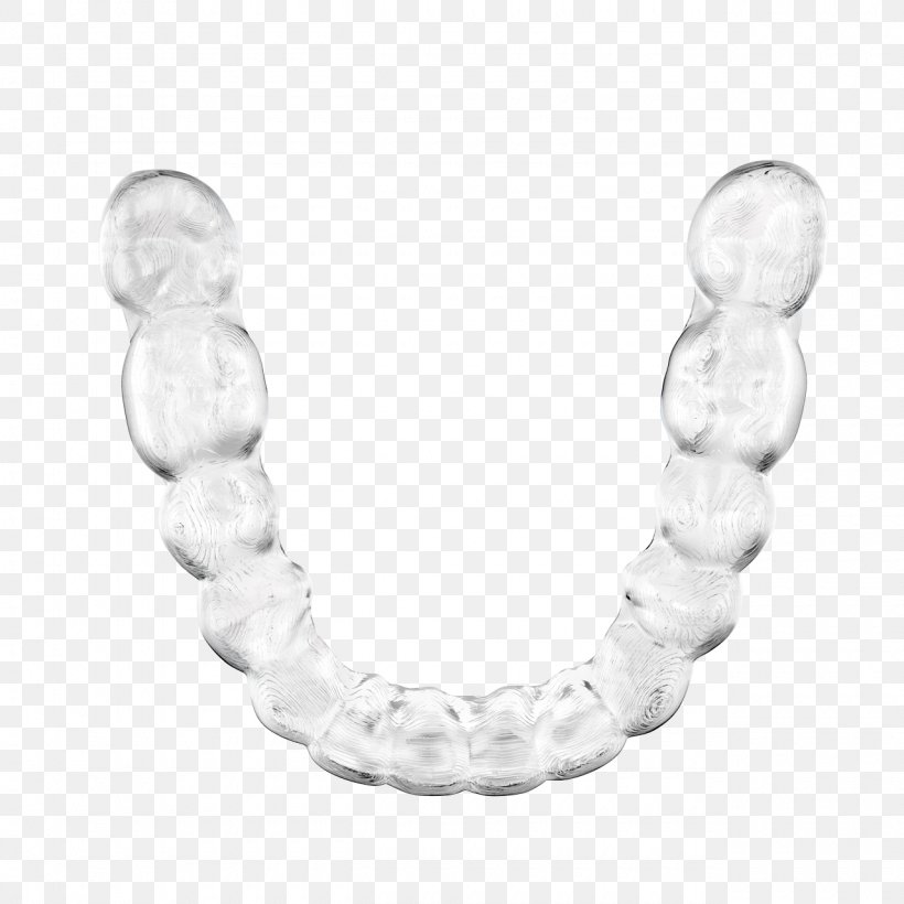 Clear Aligners Kelderman Orthodontistenpraktijk Veenendaal Orthodontics Tooth Therapy, PNG, 1280x1280px, Clear Aligners, Body Jewelry, Bracelet, Dental Braces, Fashion Accessory Download Free