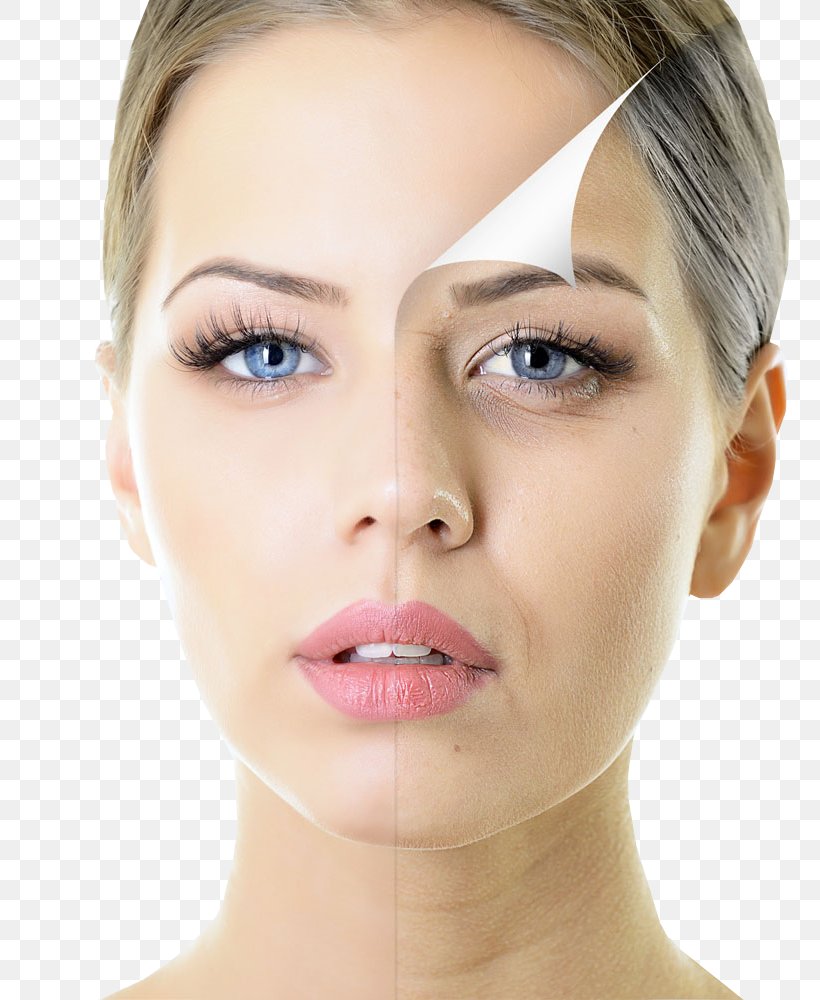 Chemical Peel Skin Care Exfoliation Facial Rejuvenation, PNG, 809x1000px, Chemical Peel, Antiaging Cream, Beauty, Blepharoplasty, Cheek Download Free