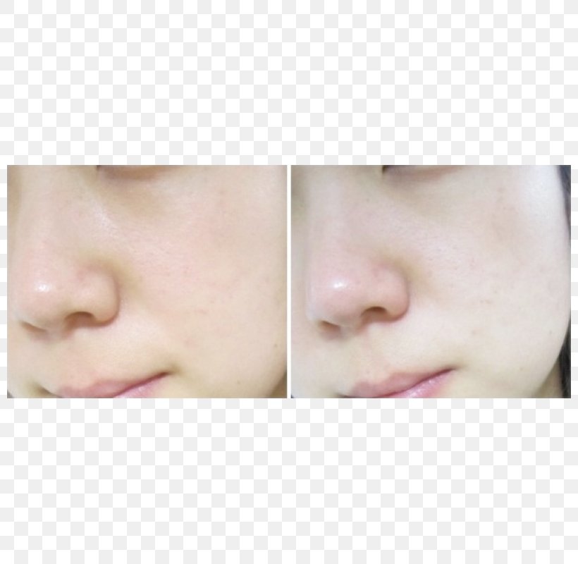 Cheek Chin Face Forehead Eyebrow, PNG, 800x800px, Cheek, Chin, Close Up, Ear, Eyebrow Download Free