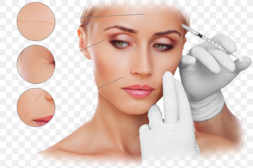 Plastic Surgery Wrinkle Botulinum Toxin RG Pro Laser, PNG, 1500x1000px, Surgery, Aesthetic Medicine, Antiaging Cream, Beauty, Botulinum Toxin Download Free