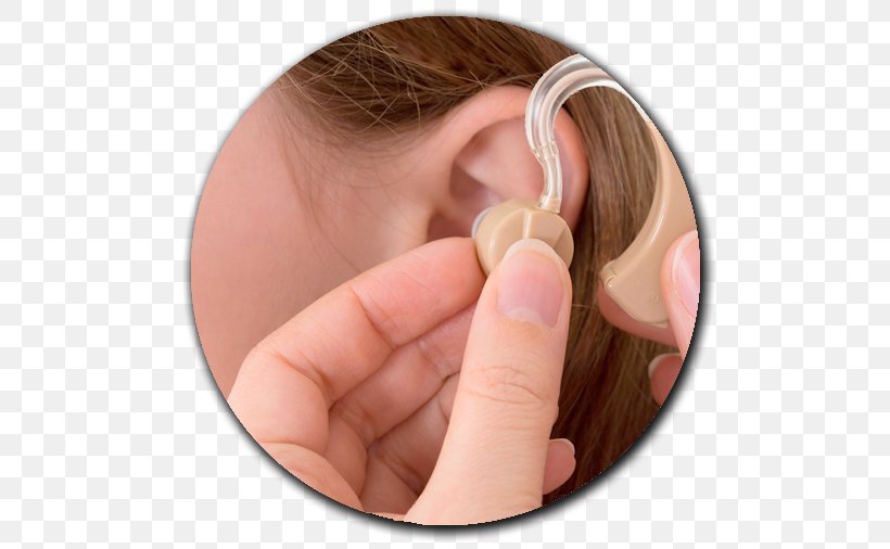 Hearing Aid Hearing Loss Otorhinolaryngology, PNG, 506x506px, Hearing Aid, Audio, Audio Equipment, Audiology, Chin Download Free