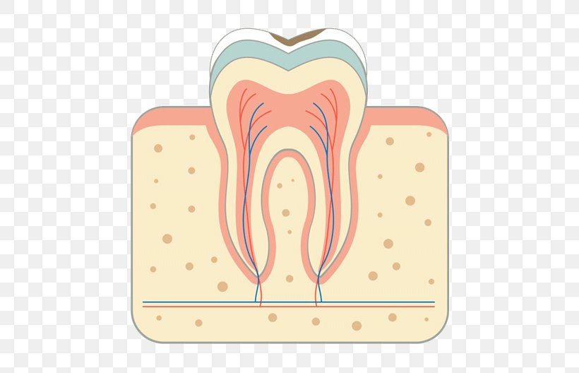 Tooth Decay Periodontal Disease Bridge Root Canal, PNG, 700x528px, Watercolor, Cartoon, Flower, Frame, Heart Download Free