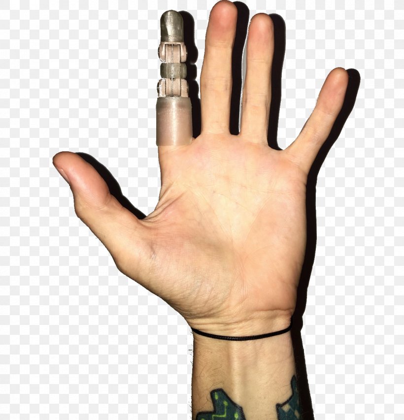 Thumb Prosthesis Hand Model Finger Glove, PNG, 1200x1249px, Thumb, Arm, Finger, Glove, Hand Download Free