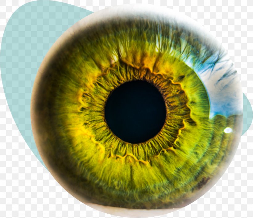 Eye Surgery Eye Injury LASIK Keratoconus, PNG, 1166x1002px, Watercolor, Cartoon, Flower, Frame, Heart Download Free