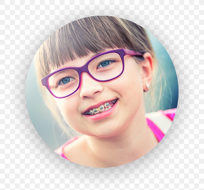 Orthodontics Dentistry Dental Braces Child, PNG, 768x766px, Orthodontics, Cheek, Child, Chin, Clear Aligners Download Free