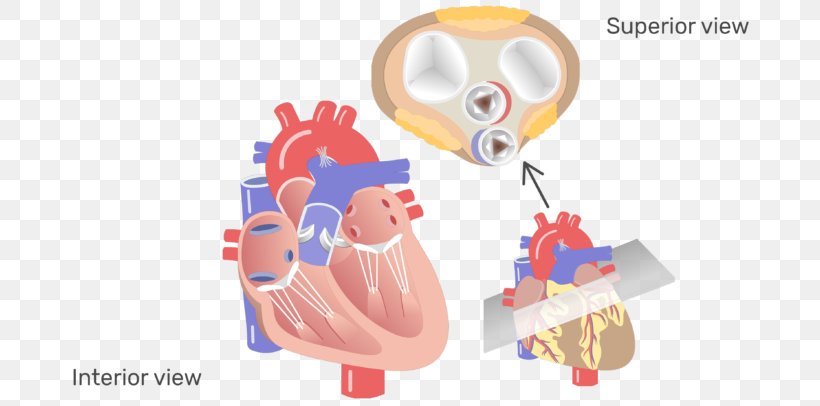 Aortic Valve Heart Valve Disease Aorta, PNG, 770x406px, Watercolor, Cartoon, Flower, Frame, Heart Download Free