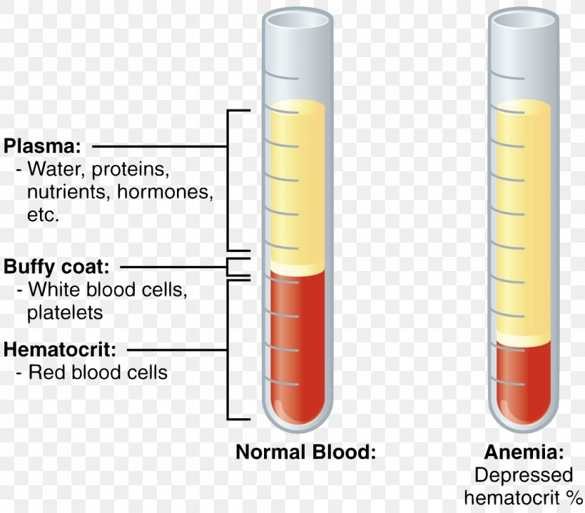 Injection Test Tubes Cylinder, PNG, 1068x937px, Injection, Cylinder, Test Tubes Download Free