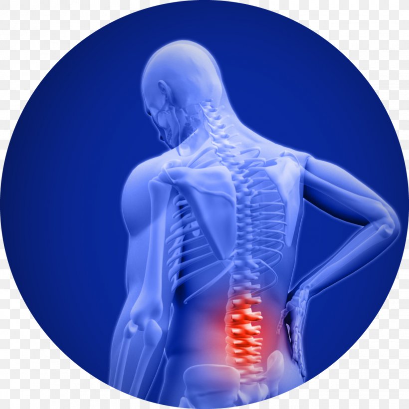 Low Back Pain Cody B. Doyle, D.C. Neck Pain Spinal Disc Herniation, PNG, 1327x1327px, Back Pain, Ache, Acute Disease, Human Back, Jaw Download Free