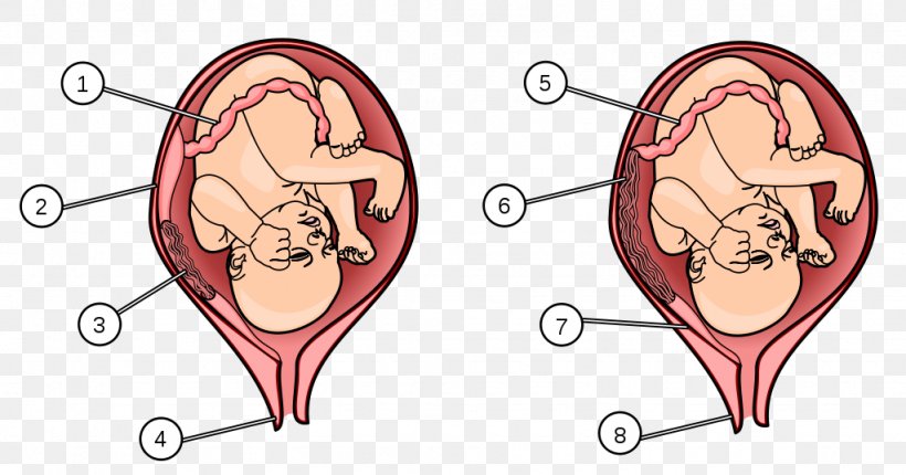 Placenta Praevia Uterus Fetus Umbilical Artery, PNG, 1024x538px, Watercolor, Cartoon, Flower, Frame, Heart Download Free