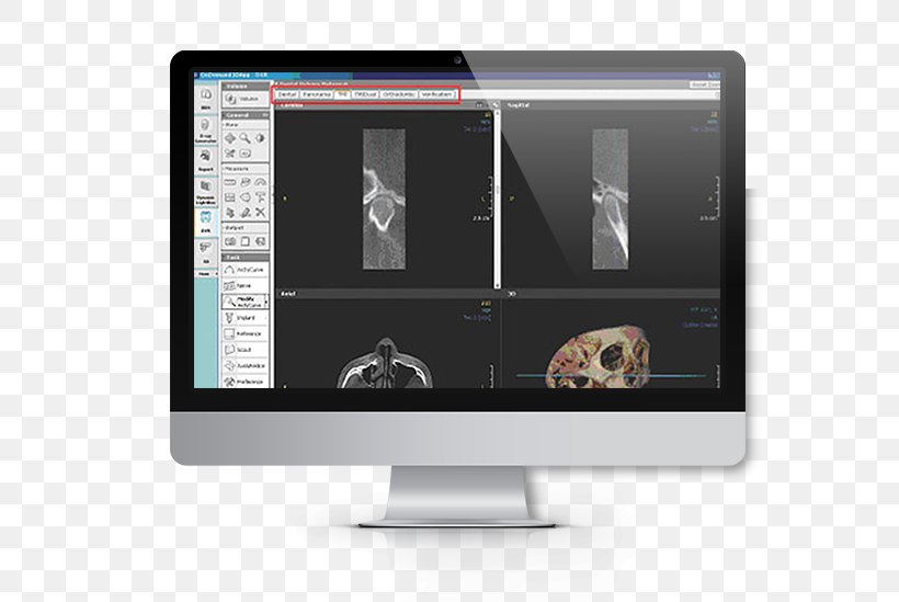 Computer Software Computer Monitors Data European Institute For Biomedical Imaging Research, PNG, 616x549px, Computer Software, Brand, Computer, Computer Monitor, Computer Monitors Download Free