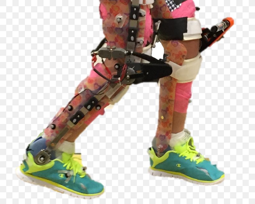 Cerebral Palsy Child Powered Exoskeleton Paralysis, PNG, 769x658px, Cerebral Palsy, Agy, Boot, Child, Disease Download Free